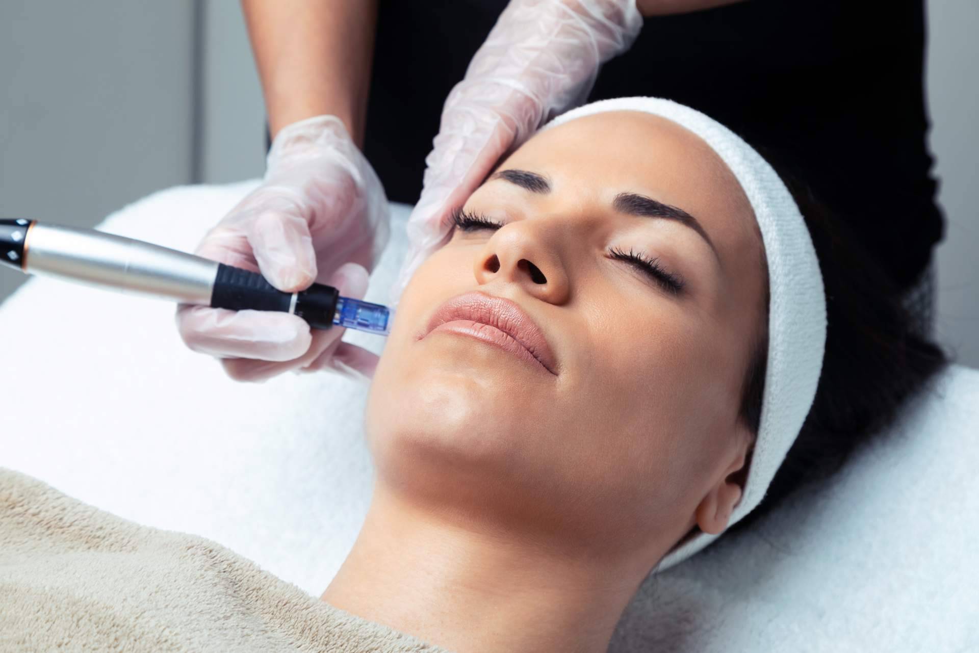El procedimiento de la mesoterapia facial de VG Virginia Gómez