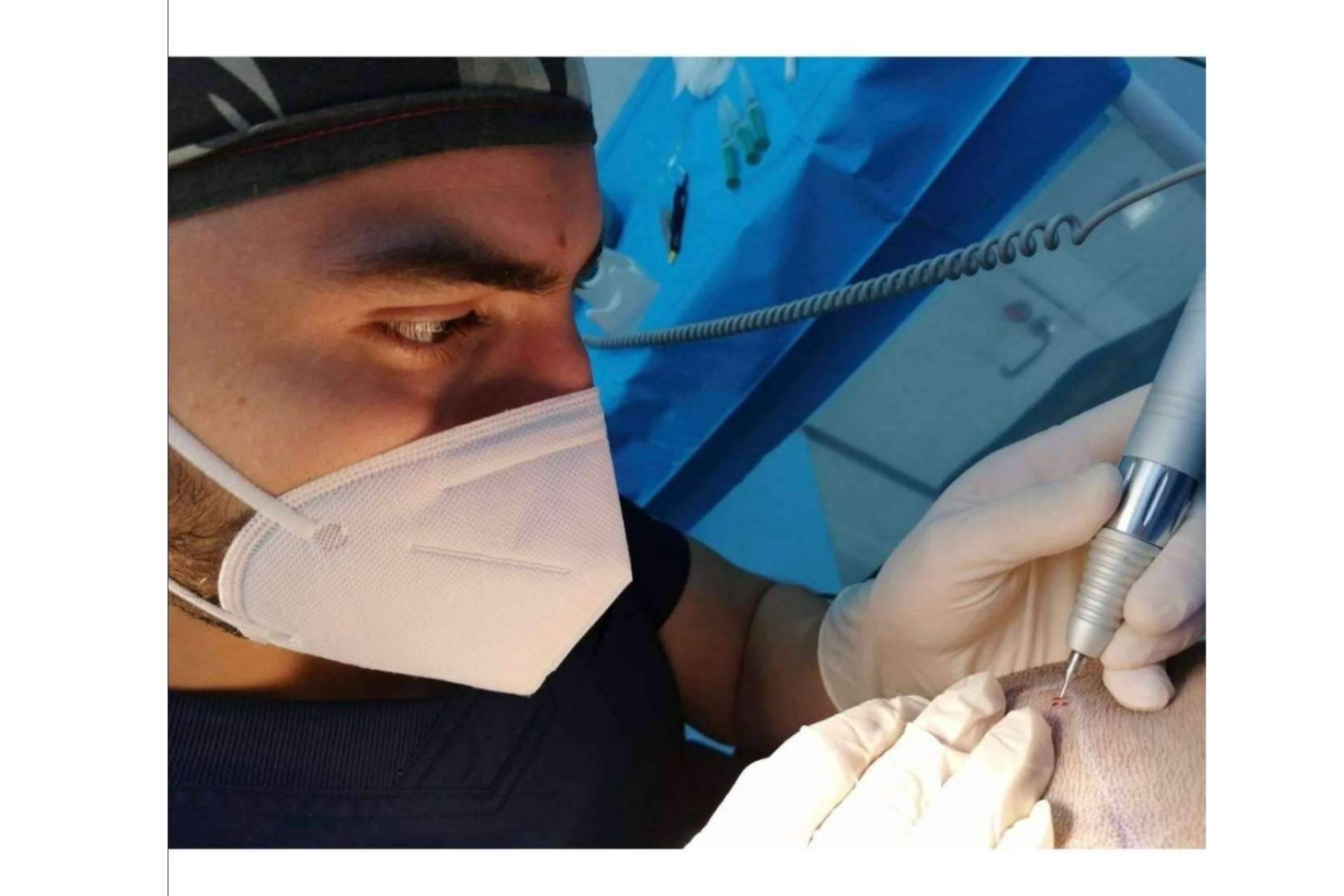 La fase del desierto capilar: ¿Cuándo se cae el pelo implantado?, por Doctor Bern