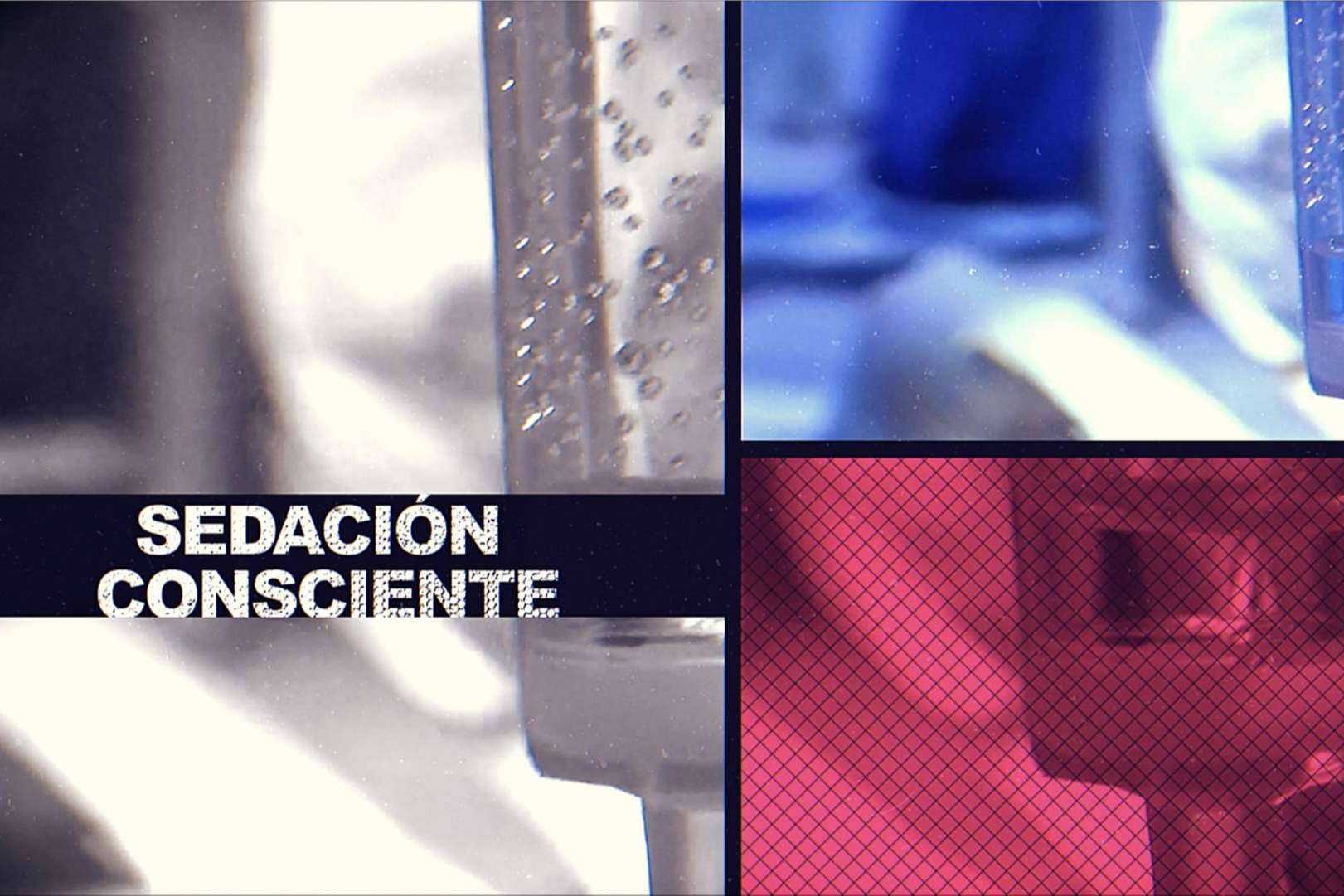 Sedación consciente en la clínica dental Formación en Implantología para aquellos pacientes nerviosos o con odontofobia