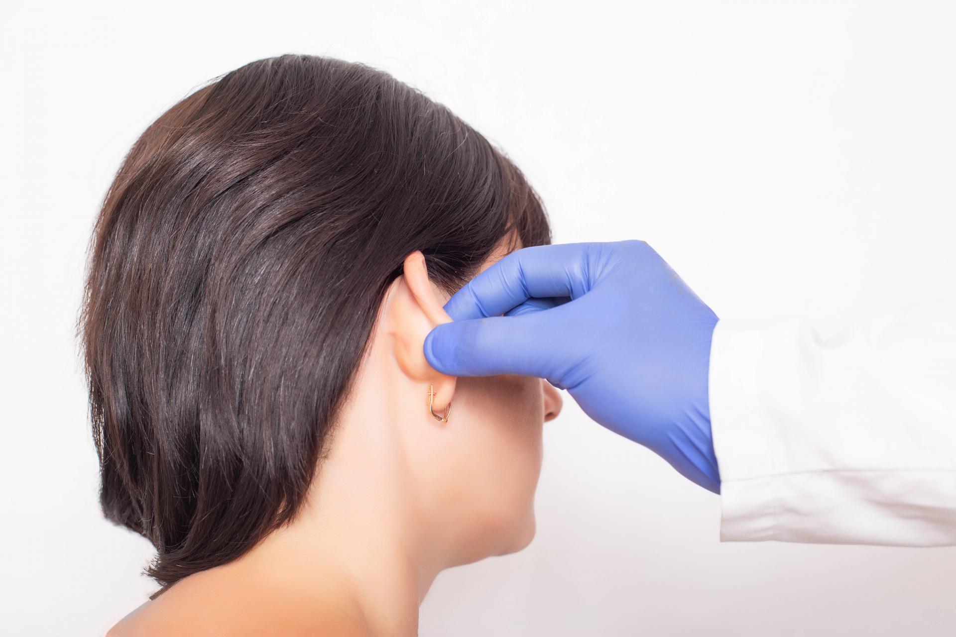 Otoplastia, una intervención quirúrgica mínimamente invasiva realizada por el Doctor Beltrán