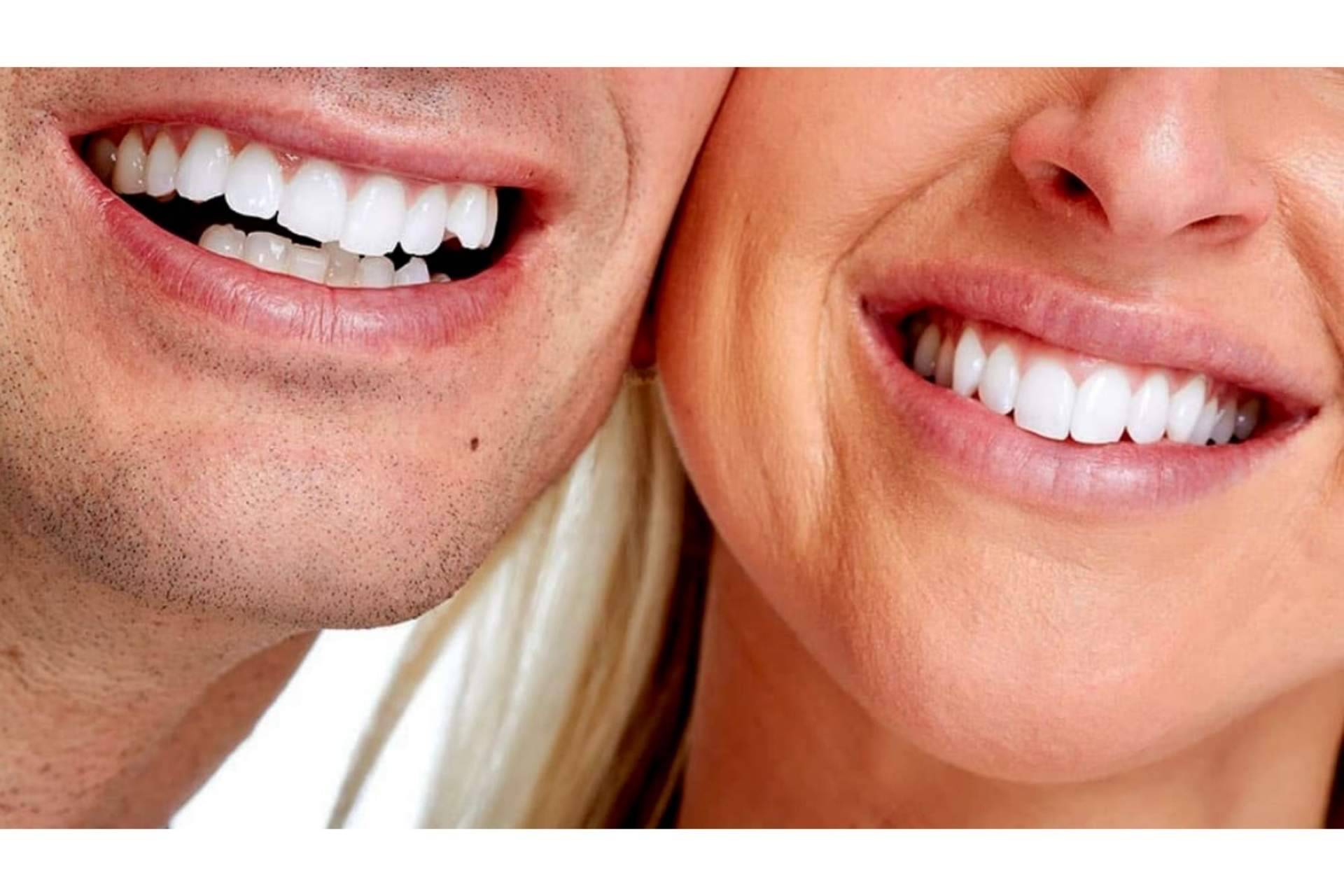 Lucir una sonrisa bonita con la ayuda de la clínica dental de Madrid, DeltaDent