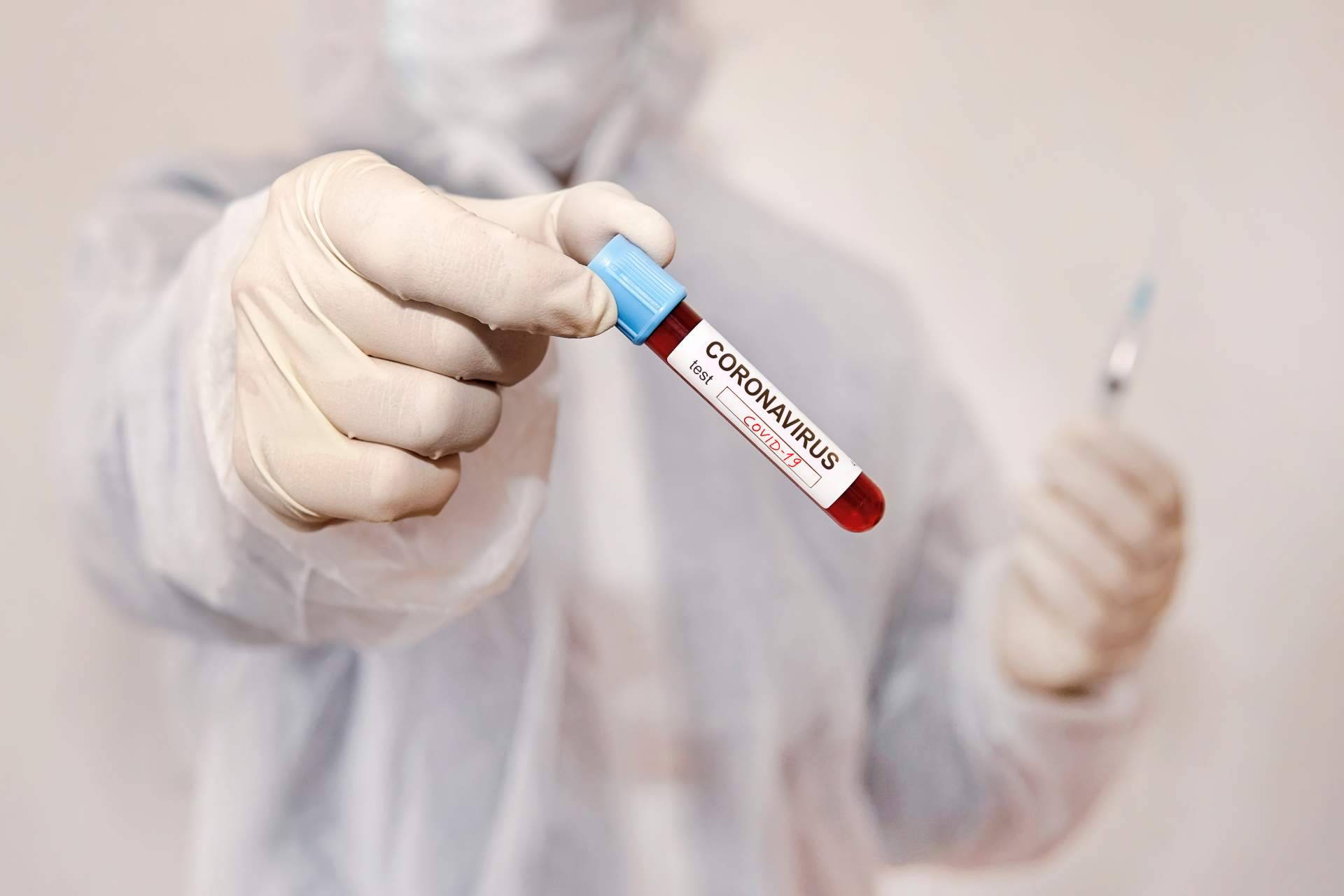 Viajar en verano gracias a las diferentes pruebas de test covid en Madrid que practica el Centro Médico Bravo
