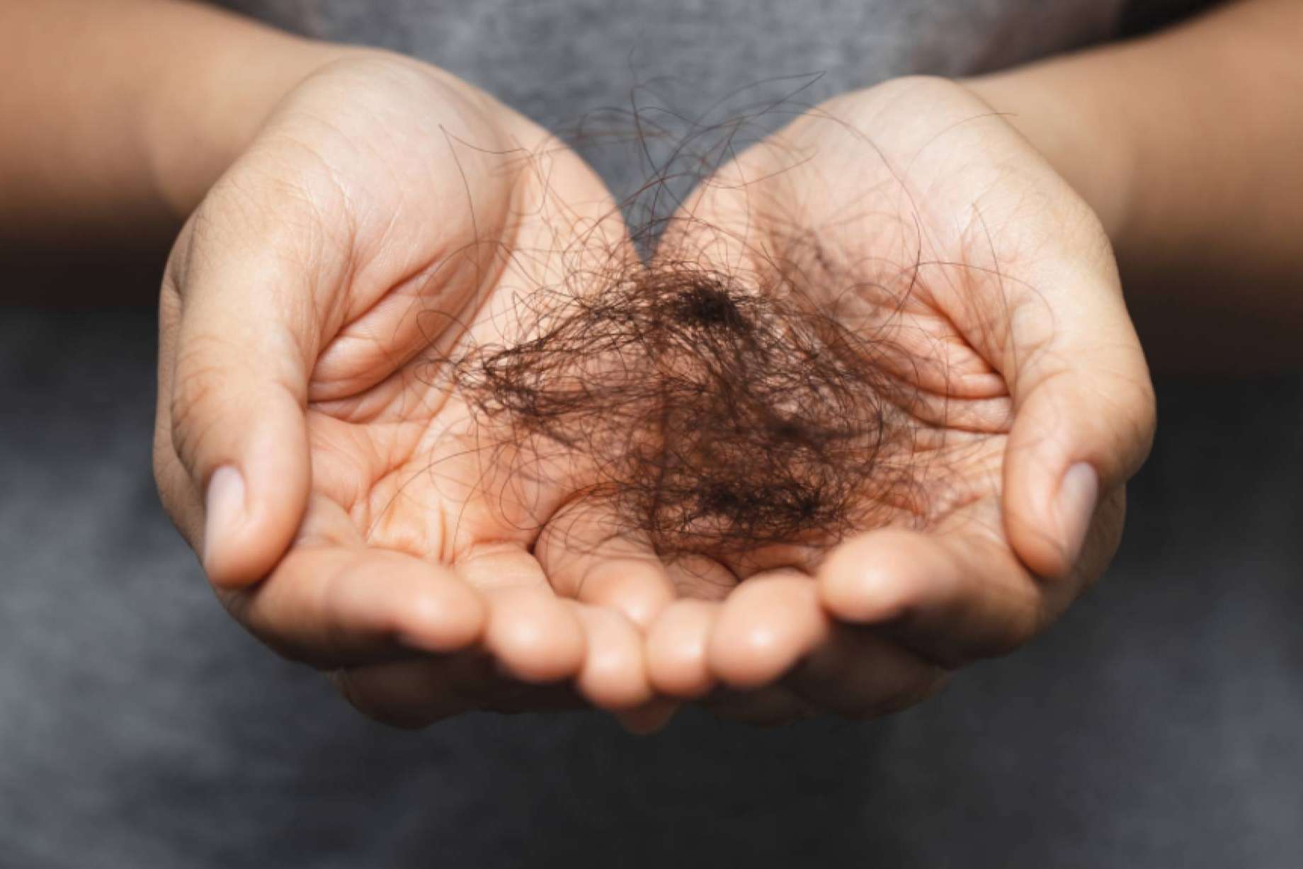 Kmax informa sobre la alopecia femenina, ¿Qué es y por qué se produce?