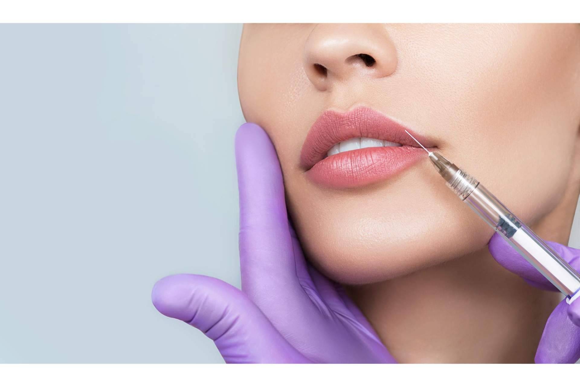 La técnica innovadora de 360Clinics para un aumento de labios, Extreme lips