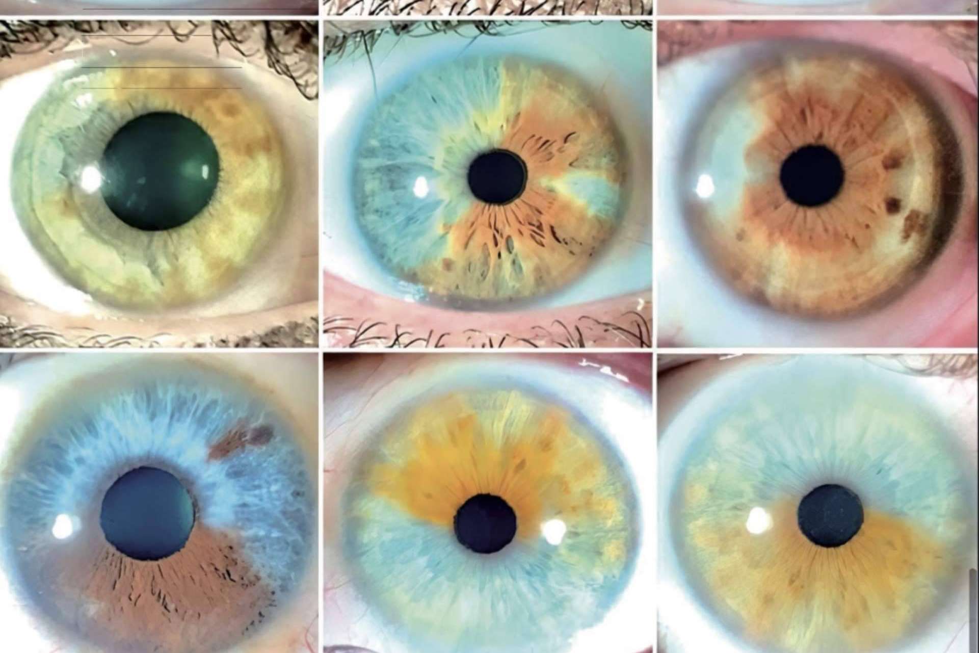La presentación del gran libro Atlas sobre el cambio de color de ojos con láser, por Eyecos