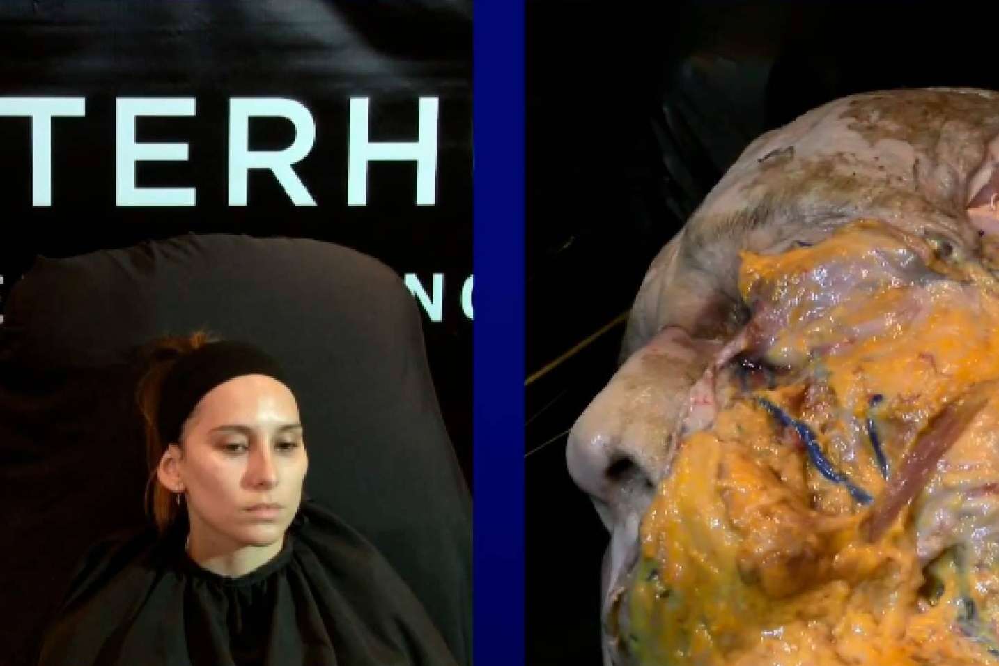 Masterhub, el congreso de medicina estética