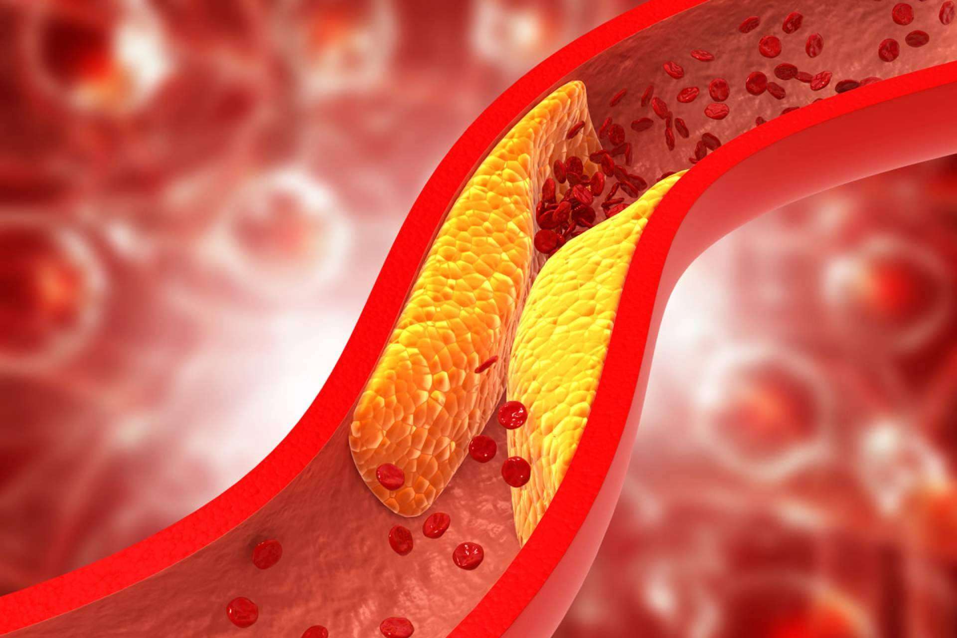 ReduCol 25 es la fórmula innovadora con levadura roja de arroz rojo de la marca Beverly Nutrition