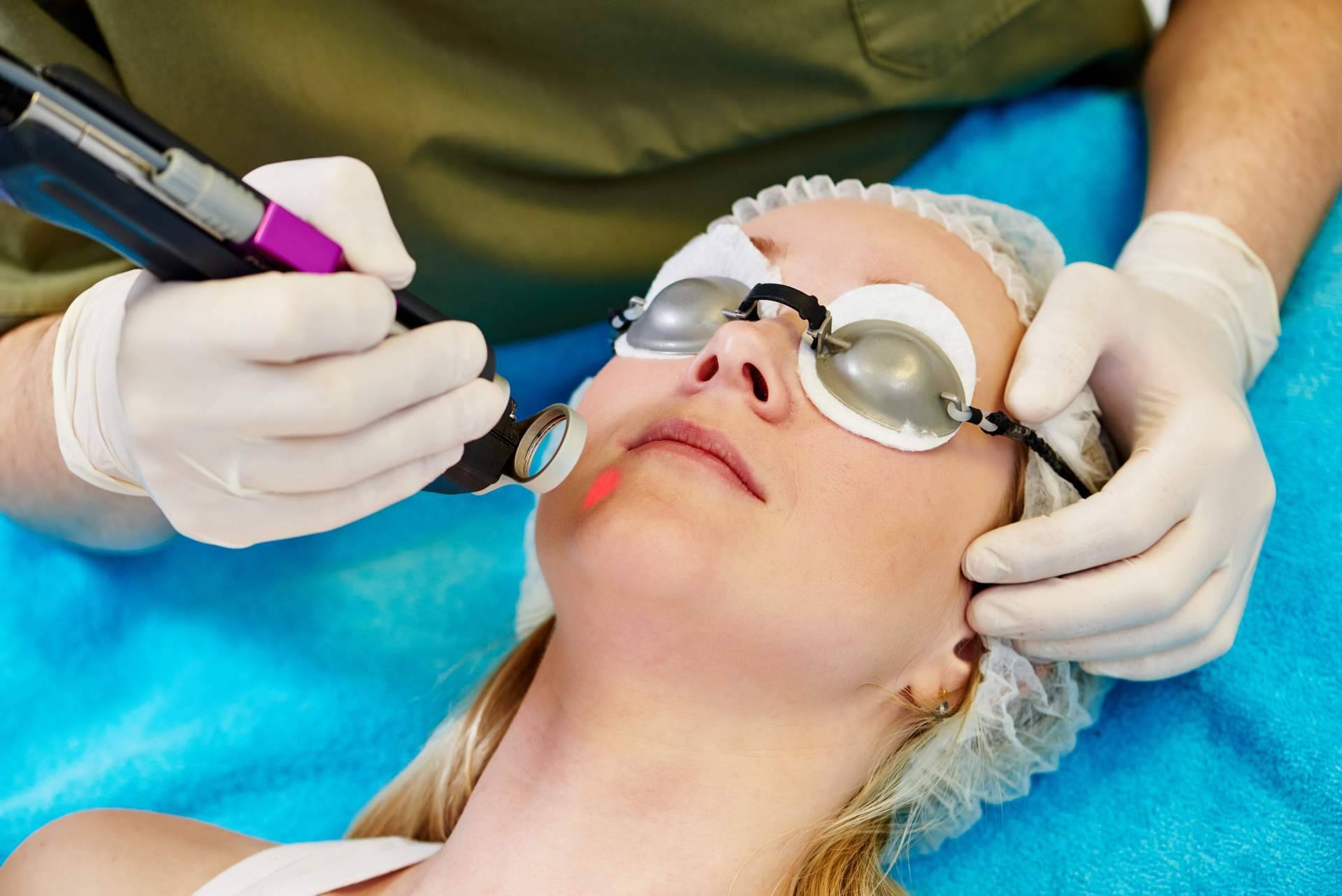 ¿Cómo eliminar las manchas en la piel? Con el láser Q Switched Nd Yag del Centro Médico El Pilar