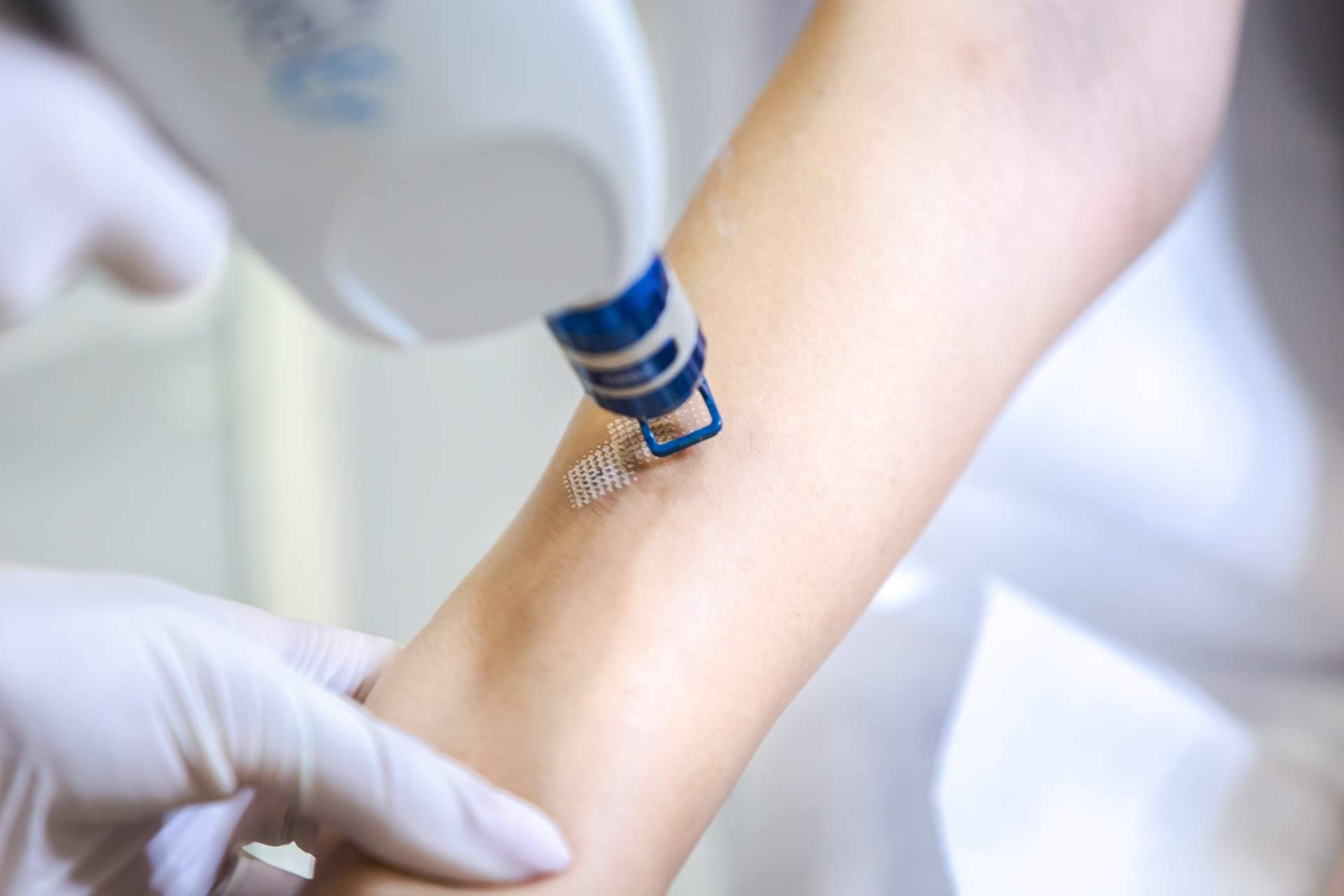 Técnicas avanzadas para eliminar cicatrices, de la mano de Centro Estética El Pilar
