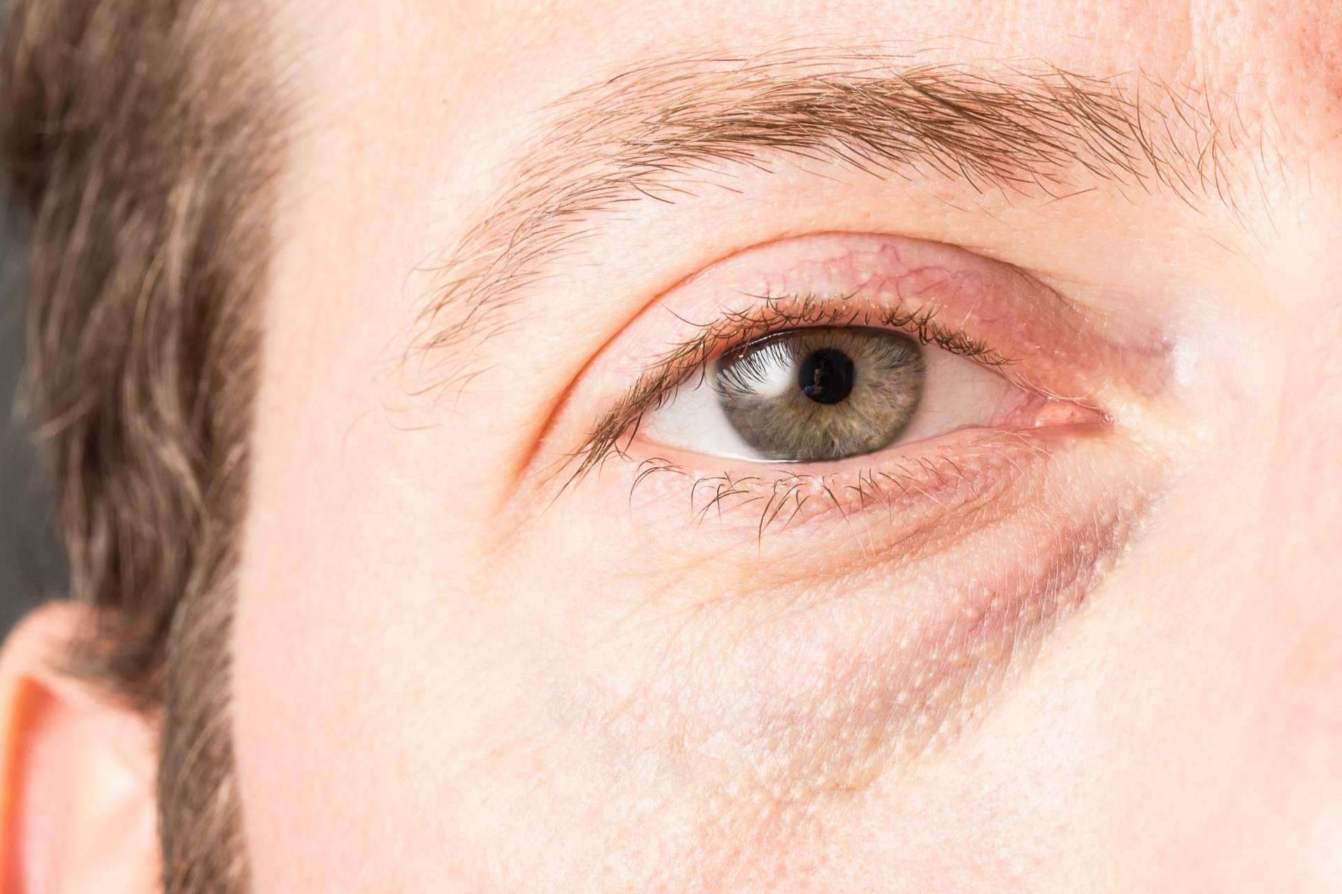 Tratamiento Banzeye para las ojeras; innovación en el cuidado masculino