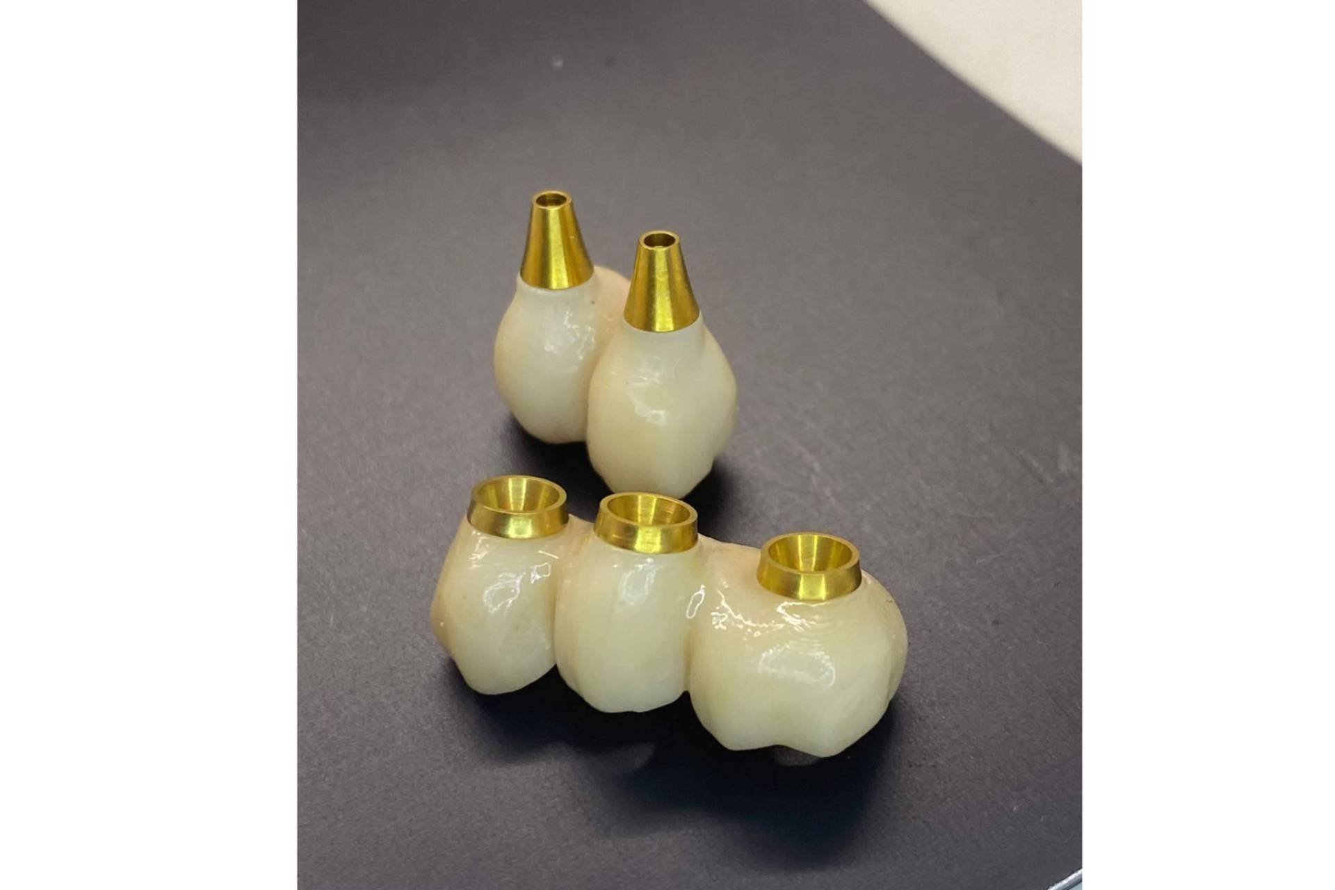 Tecnología avanzada 3D para una sonrisa perfecta en una visita, con Dentinova