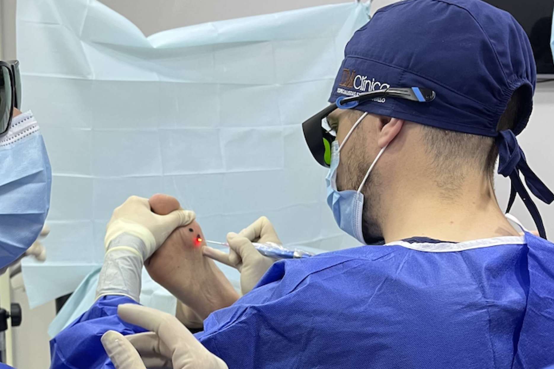Innovador tratamiento láser para cirugías de uñas y papilomas en el pie, de la mano de DM Clínica