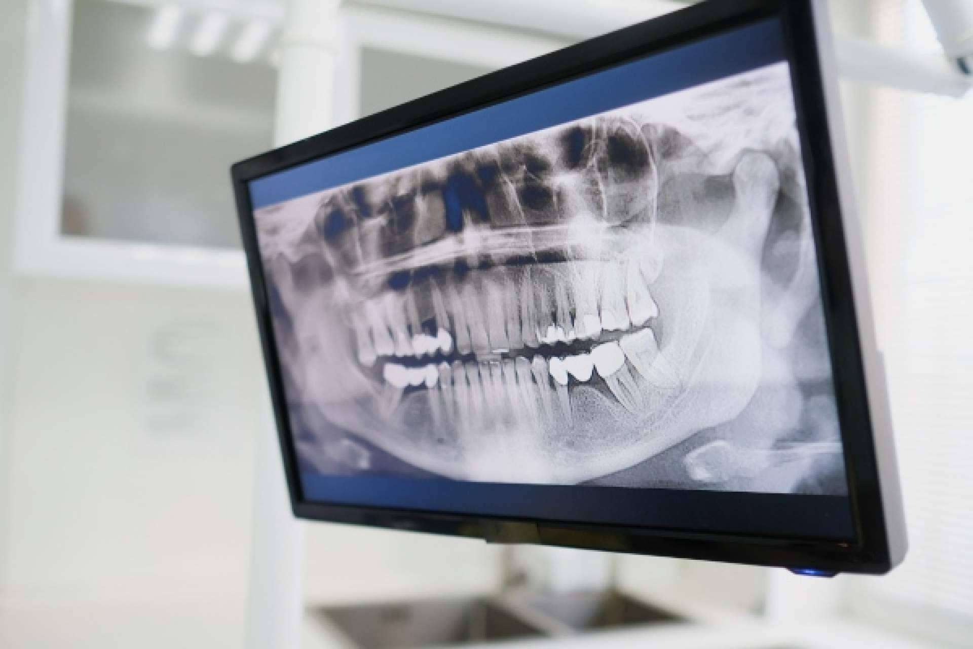 Conseguir una sonrisa saludable con los servicios de odontología avanzada de Denty Dent