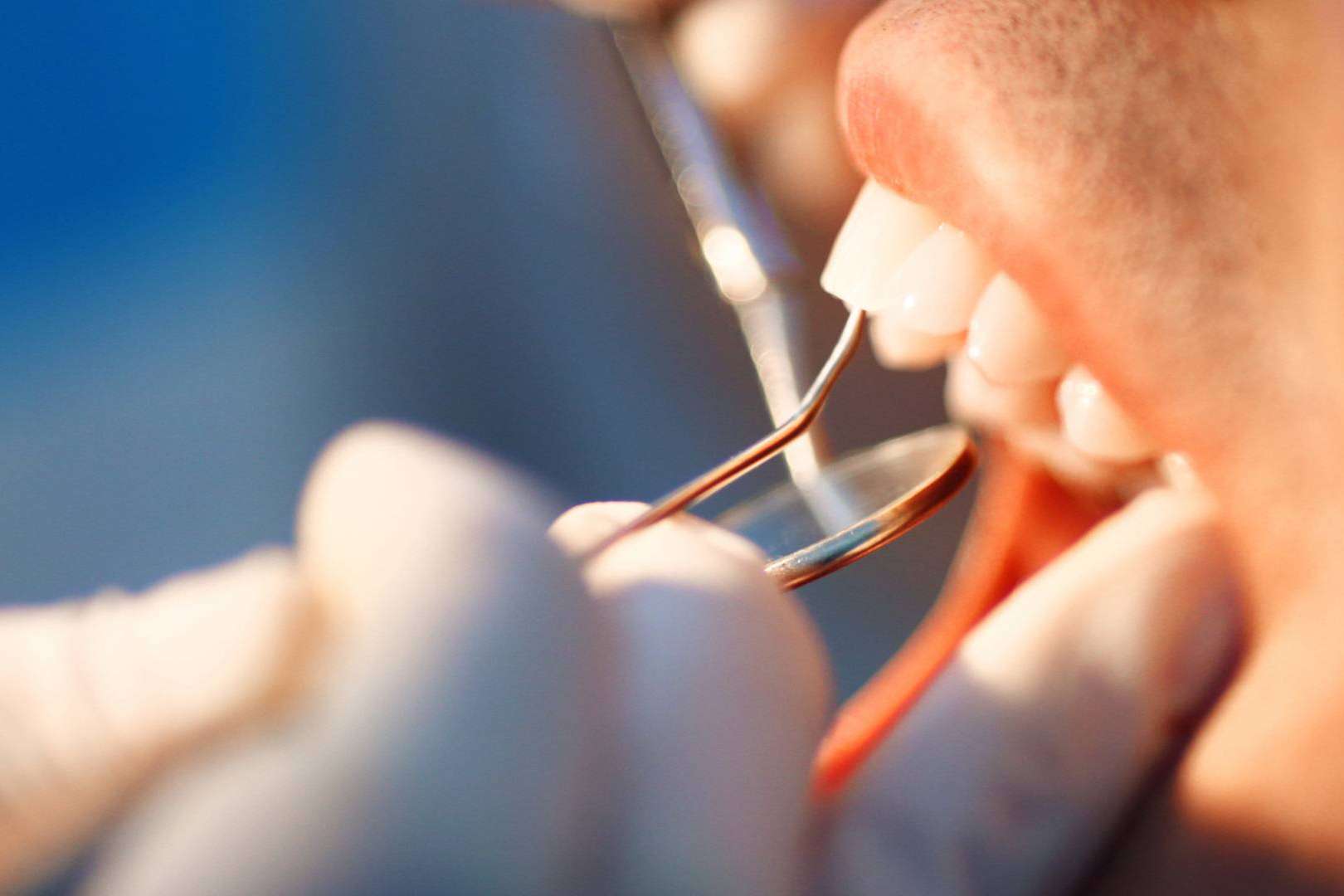 Tratamiento para la periodontitis; en qué consiste y cuánto cuesta