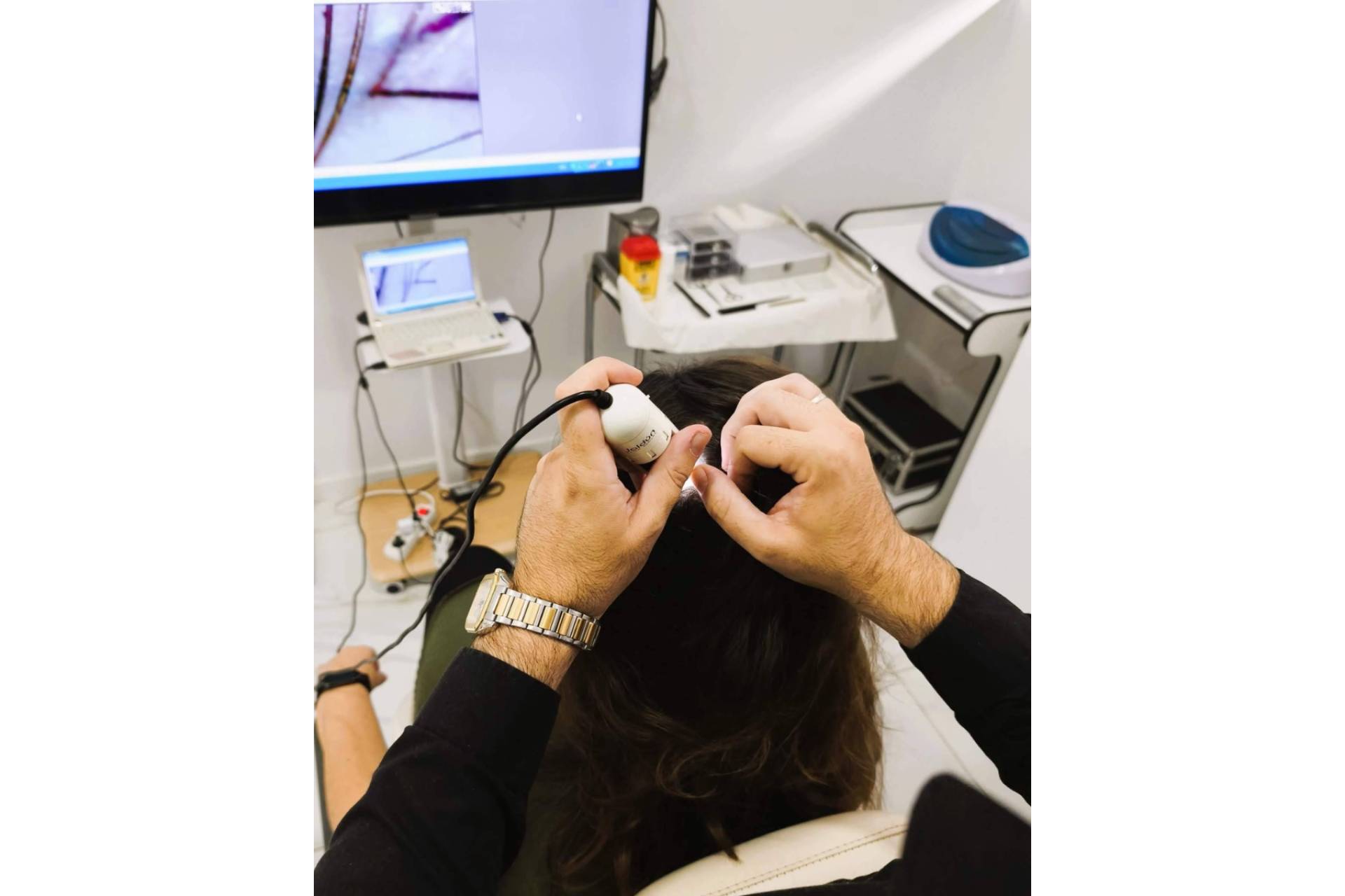 Pardo Centro Capilar une imagen, análisis y seguimiento para actuar ante la alopecia desde el diagnóstico capilar